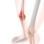 姿勢由来の膝痛改善方法とは？